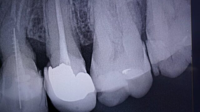01_ansreas_tsourapas_dentist_